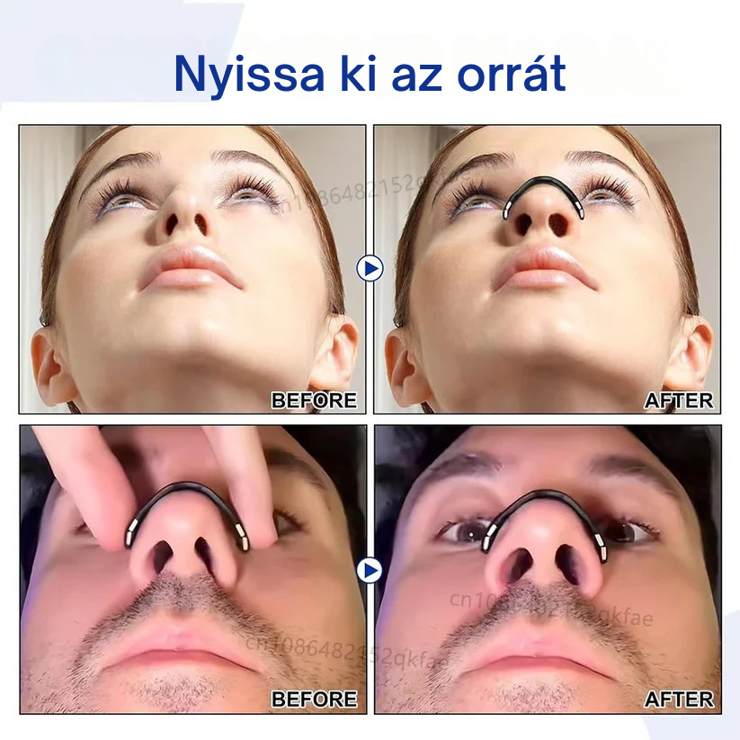 OPEN YOUR NASAL (4)