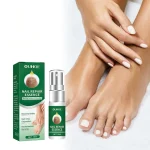 Magiczny spray na grzybicę paznokci